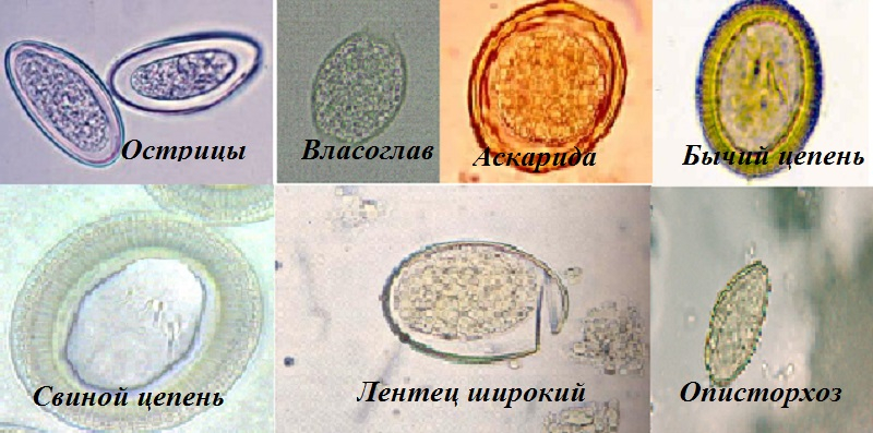 копрограмма кала расшифровка у детей